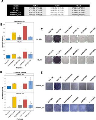 Differential modulation of mutant CALR and JAK2 V617F-driven oncogenesis by HLA genotype in myeloproliferative neoplasms